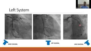 Webinar 10, Coronary Angiogram ( Discussion & Decision making )