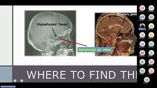 Endocrine Mid-unit Revision I Rashid and Abdallah I Crash Course