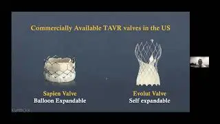 New Frontiers in Structural Heart Disease