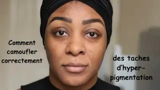 Comment: Camoufler des taches d'hyper-pigmentation (Peau Noir)
