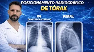 RAIO-X DE T&Oacute;RAX NA INCID&Ecirc;NCIA P&Oacute;STERO-ANTERIOR (PA) E PERFIL. 