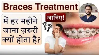 Braces Lagwaye? Har Mahine Dentist Ke Paas Kyun Jana Padta Hai 😱 | REAL Reason No One Tells You!
