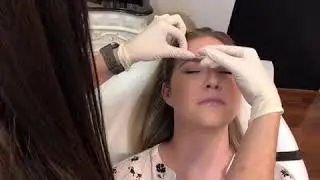 Lip filler in Westlake at Hall Plastic Surgery