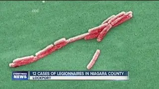 Outbreak of Legionnaires Disease in Niagara County