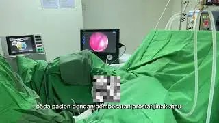 Operasi Prostat TURP Transurethral Resection Of The Prostate