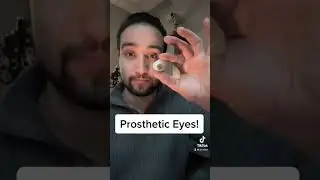Prosthetic Eye! #eyehealth #eyedoctor #youtube #youtubeshorts