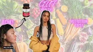TIPS TO GET YOUR GUT HEALTH TOGETHER + CLEAR SKIN