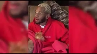 I got my wisdom teeth removed