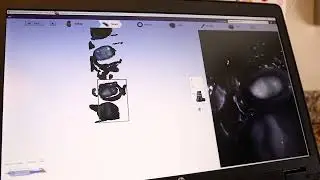 3D Mapping at Integrity Dental