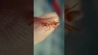MICROSCOPIC ANT BITE VIEW || MICROSCOPIC WORLD || #SHORTS || #SHREESHORTS ||