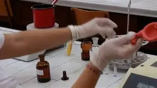 Glukoza u krvi (&Scaron;UK) - o-toluidinska metoda. Glucose in blood - o-toluidine method