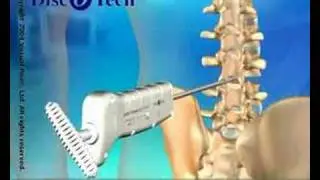 Variety of sciences, 3D medical animation produced by Virtual Point
