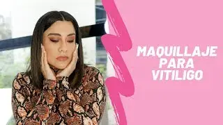 TUTORIAL: MAQUILLAJE PARA VITILIGO | PINK CHICK