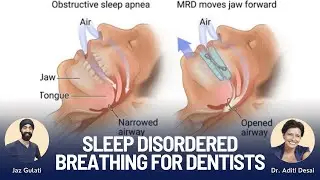 Sleep Disordered Breathing and Dentistry - PDP139