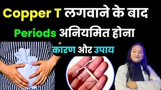 Copper T lagwane ke baad beech beech mai Bleeding hona ya period Irregular hone ka karan? IUD