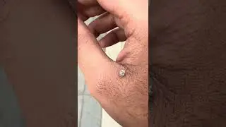 Guess which insect it is ??? 🧐🧐🧐 &hellip;. #interesting facts #explore #trending