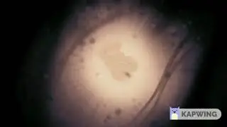 Hollow Knight Infection Scream sound effect.