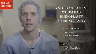 A Story Of Patient Whom Had Rhinoplasty-3D Rhinoplasty- DR. KARAALTIN