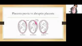Maternal Newborn Part 1