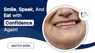 Dentures in Toronto | Restore Your Smile at Smile Dental Centre