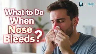 How to Handle Nosebleeds Quickly | Doctor-Approved Home Tips #Nosebleed #FirstAid #HealthTips