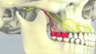 Best Dentist In Woodbury, MN -- Headaches, Migraines,& Face Pain 651-436-7559
