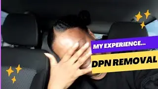 My DPN (Dermatosis Papulosa Nigra) Removal Experience - Review and Recommendations