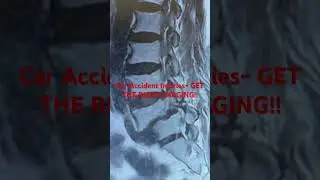 Car Accident Injuries? Here&rsquo;s Why the RIGHT Imaging Matters 🚗📸&rdquo;