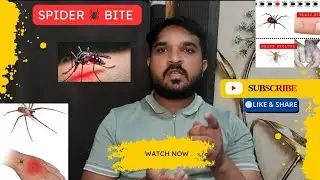 Spider bite क्या होता हैं कारण लक्षण और इलाज 