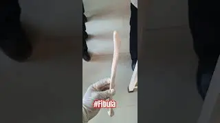 The Fibula bone 3D Anatomy [Lower limb 🦵🏻]#mbbs #anatomy #bones #humananatomy #fibula #lowerlimb