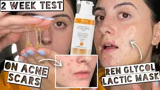 TESTING $58 REN GLYCOL LATIC RADIANCE RENEWAL MASK FOR 2 WEEKS FOR ACNE SCARS