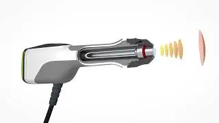 MASTERPULS&reg; icon &ndash; Radial Shock Wave Therapy System for Clinical Practice | STORZ MEDICAL