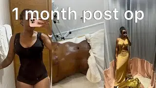 Q&A 1 month post op Breast reduction & Ab muscle repair| Mommy makeover