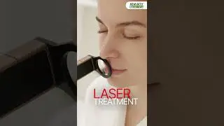 Laser Hair Removal at Keya Seth Medispa | Permanent Hair Reduction Treatment