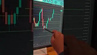Intraday Options Trading Profit Strategy | Stock Market | Being Trader