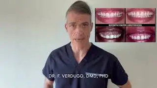 LIFE changing procedure: GUMMY SMILE CORRECTION