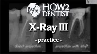 How to take accurate intraoral X-Ray / How to Dentist