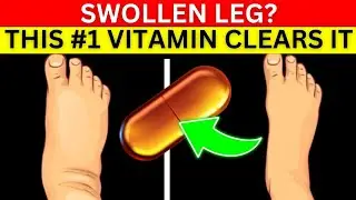Seniors, This is The #1 Vitamin  You Need To Eliminate Swollen Legs & Ankles