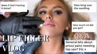 COME WITH ME TO GET LIP FILLER | FILLER VLOG AND Q&A