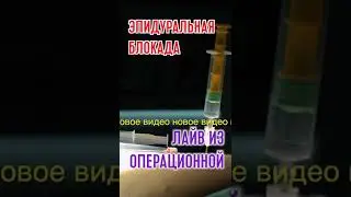 Эпидуральная блокада | лайв из операционной #Ерошкин #блокада #нейрохирург #shorts #киев #стеноз