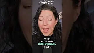 REAL Skin Rash Transformations! #shorts