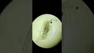 zooplankton #microscopiclife #smallcreatures#aquaticlife #fishfood #plankton #viralvideo #oceanlife