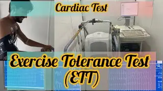 Exercise Tolerance Test (ETT) || The Role of ETT in Diagnosing Coronary Artery Disease #short #viral