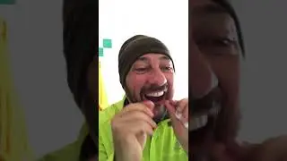 Sbianco i denti