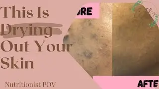 4 Surprising Effects Sugar Has On Your Skin | Cultivating Inner Beauty