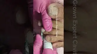 full video pedicure and dryskin removal