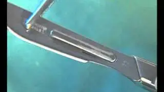 Fitting A Swann-Morton Surgical Blade