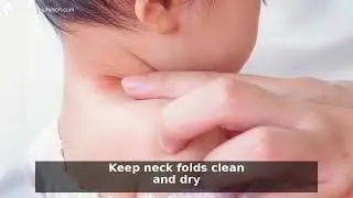 Baby Neck Rash Relief: 7 Tips for Gentle Prevention & Care