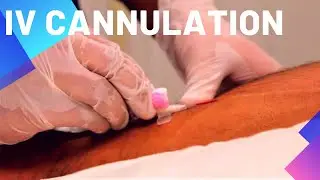 IV Cannulation Procedure - OSCE Exam Demonstration