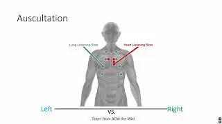 ACM Arma 3: Treating Thoracic Injuries – Medical Guide